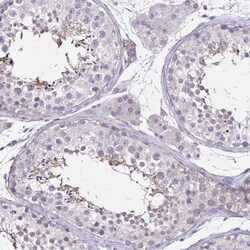 ULBP-3 Antibody, Novus Biologicals 0.1mL; Unlabeled:Antibodies, Polyclonal